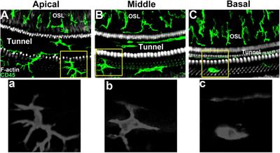 Macrophage-related immune responses in inner ear: a potential therapeutic target for sensorineural hearing loss